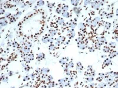 Immunohistochemistry-Paraffin: Nucleolin Antibody (NCL/7014R) [NBP3-11037]