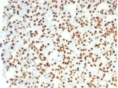 Immunohistochemistry-Paraffin: Nucleolin Antibody (NCL/7014R) [NBP3-11037]