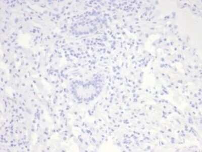 Immunohistochemistry-Paraffin: Nucleolin Antibody (NCL/7014R) [NBP3-11037]