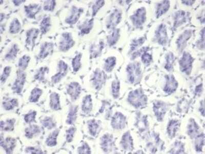 Immunohistochemistry-Paraffin: Nucleolin Antibody (NCL/7014R) [NBP3-11037]