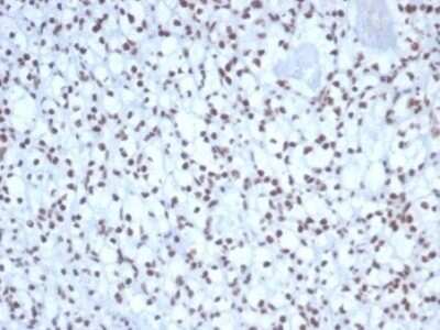 Immunohistochemistry-Paraffin: Nucleolin Antibody (NCL/7338) [NBP3-13980]