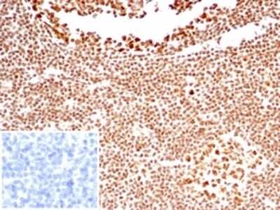 Immunohistochemistry-Paraffin: Nucleolin Antibody (NCL/7338) [NBP3-13980]
