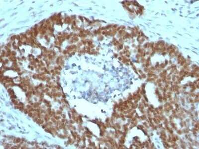 Immunohistochemistry-Paraffin: Nucleolin Antibody (NCL/902) - Azide and BSA Free [NBP2-47860]
