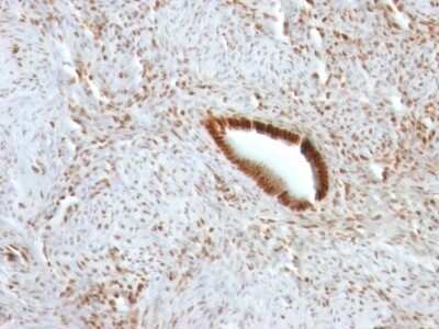 Immunohistochemistry-Paraffin: Nucleolin Antibody (NCL/902) - IHC-Prediluted [NBP2-48317]