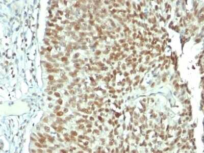 Immunohistochemistry-Paraffin: Nucleolin Antibody (NCL/902) [NBP2-44610]