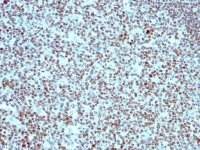 Immunohistochemistry-Paraffin: Nucleolin Antibody (SPM614) - IHC-Prediluted [NBP2-48318]