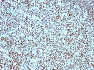 Immunohistochemistry-Paraffin: Nucleolin Antibody (SPM614) [NBP2-44611]