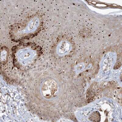 Immunohistochemistry-Paraffin: Nucleoplasmin-3 Antibody [NBP1-90907]