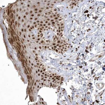 Immunohistochemistry-Paraffin: Nucleoplasmin-3 Antibody [NBP1-90999]