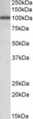 Western Blot: Nucleoporin 107 Antibody [NBP1-49841]