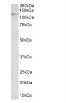 Western Blot: Nucleoporin 107 Antibody [NBP1-49841]