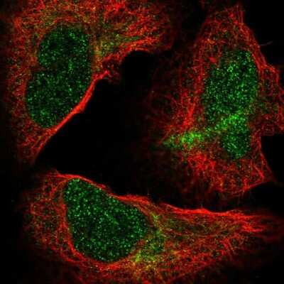 Immunocytochemistry/ Immunofluorescence: Nucleoporin NUP85 Antibody [NBP2-56709]