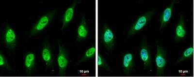 Immunocytochemistry/ Immunofluorescence: NUP62 Antibody [NBP1-31381]