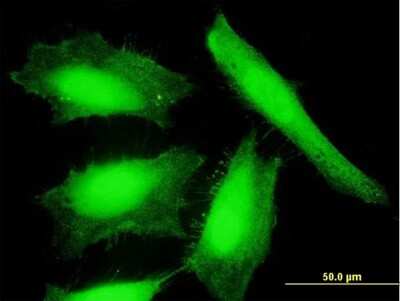 Immunocytochemistry/ Immunofluorescence: Nucleoredoxin Antibody [H00064359-B01P]