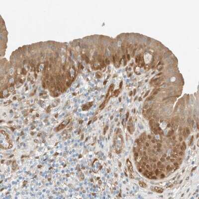Immunohistochemistry-Paraffin: Nucleoredoxin Antibody [NBP1-82289]