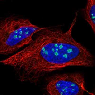 Immunocytochemistry/ Immunofluorescence: Nucleostemin Antibody [NBP2-38326]
