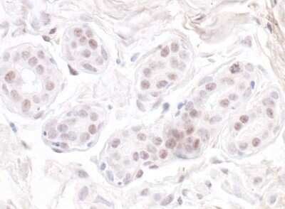 Immunohistochemistry: Nucleostemin Antibody [NB100-1569]