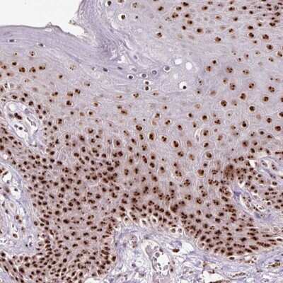 Immunohistochemistry: Nucleostemin Antibody [NBP2-38325]