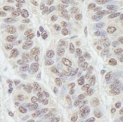 Immunohistochemistry-Paraffin: Nucleostemin Antibody [NB100-1569]