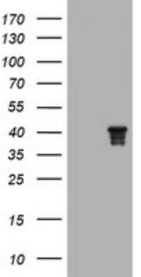 Western Blot: Nudel Antibody (OTI1G7) [NBP2-45855]