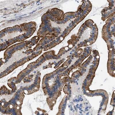 Immunohistochemistry-Paraffin: Nudel Antibody [NBP1-92206]
