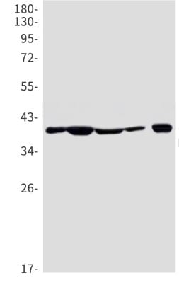 Western Blot: Nudel Antibody (S05-1D0) [NBP3-19994]
