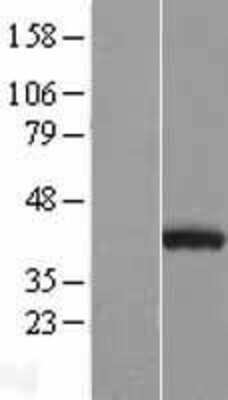Western Blot: Nudel Overexpression Lysate [NBL1-13523]