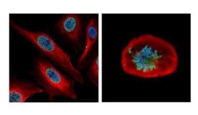 Immunocytochemistry/ Immunofluorescence: Nuf2 Antibody [NBP1-31632]