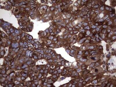 Immunohistochemistry: Numb Antibody (OTI1B5) [NBP2-46284]