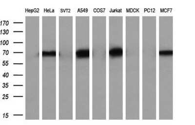 Western Blot: Numb Antibody (OTI4F3)Azide and BSA Free [NBP2-73129]