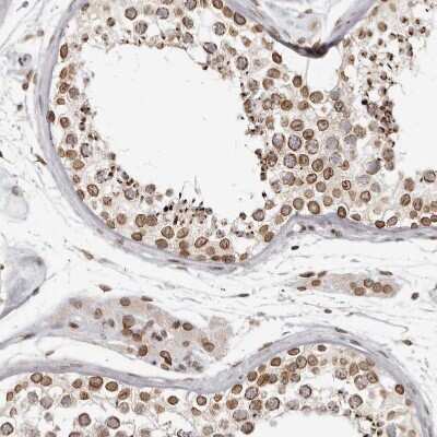 Immunohistochemistry-Paraffin: Nup153 Antibody [NBP1-81724]