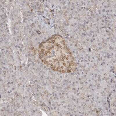 Immunohistochemistry-Paraffin: Nup153 Antibody [NBP1-81725]