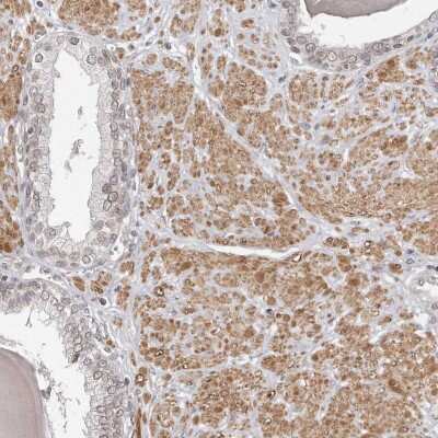 Immunohistochemistry-Paraffin: Nup153 Antibody [NBP1-81725]