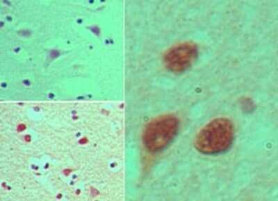 Immunohistochemistry-Paraffin: Nup53 Antibody [NBP2-24637]
