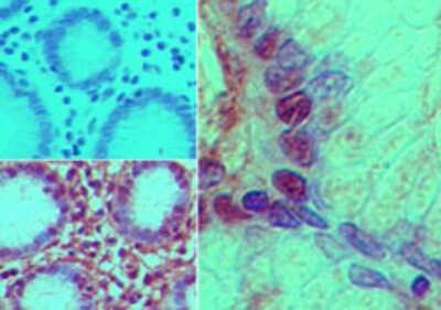 Immunohistochemistry-Paraffin: Nurim Antibody [NB100-56414]