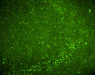 Immunohistochemistry: Nurr1/NGFI-B beta/NR4A2 Antibody - BSA Free [NB110-40415]