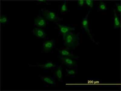 Immunocytochemistry/ Immunofluorescence: Nurr1/NGFI-B beta/NR4A2 Antibody (1C6) [H00004929-M10]