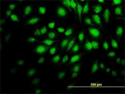 Immunocytochemistry/ Immunofluorescence: Nurr1/NGFI-B beta/NR4A2 Antibody (1G6) [H00004929-M02]