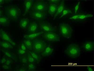Immunocytochemistry/ Immunofluorescence: Nurr1/NGFI-B beta/NR4A2 Antibody (2G5) [H00004929-M08]