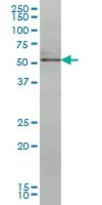 Western Blot: Nurr1/NGFI-B beta/NR4A2 Antibody (2G5) [H00004929-M08]