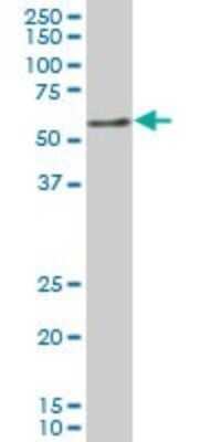 Western Blot: Nurr1/NGFI-B beta/NR4A2 Antibody (2G5) [H00004929-M08]