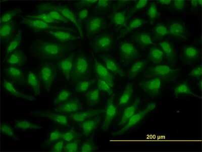 Immunocytochemistry/ Immunofluorescence: Nurr1/NGFI-B beta/NR4A2 Antibody (4A6) [H00004929-M07]
