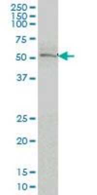 Western Blot: Nurr1/NGFI-B beta/NR4A2 Antibody (4A6) [H00004929-M07]