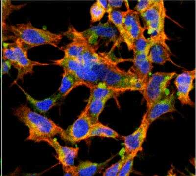 Immunocytochemistry/ Immunofluorescence: O-GlcNAc Antibody (9H6) [NBP2-59385]