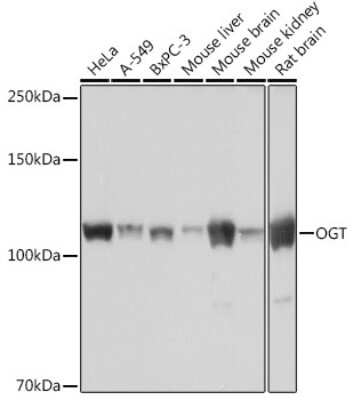 Western Blot: O-GlcNAc Transferase p110 subunit Antibody (3Q9B8) [NBP3-16203]