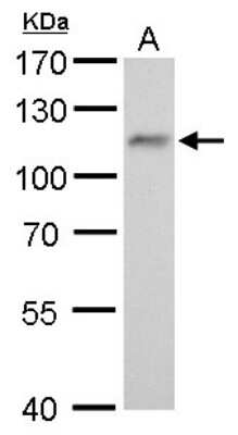 Western Blot: O-GlcNAc Transferase p110 subunit Antibody (678) [NBP2-43590]
