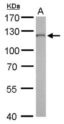Western Blot: O-GlcNAc Transferase p110 subunit Antibody (678) [NBP2-43590]