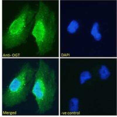 Immunocytochemistry/ Immunofluorescence: O-GlcNAc Transferase p110 subunit Antibody [NB100-57845]