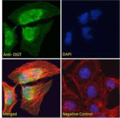 Immunocytochemistry/ Immunofluorescence: O-GlcNAc Transferase p110 subunit Antibody [NB100-57845]