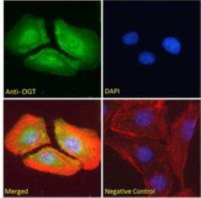 Immunocytochemistry/ Immunofluorescence: O-GlcNAc Transferase p110 subunit Antibody [NB100-57845]